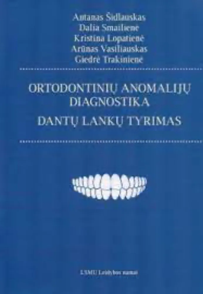 Ortodontinių anomalijų diagnostika. Dantų lankų tyrimas