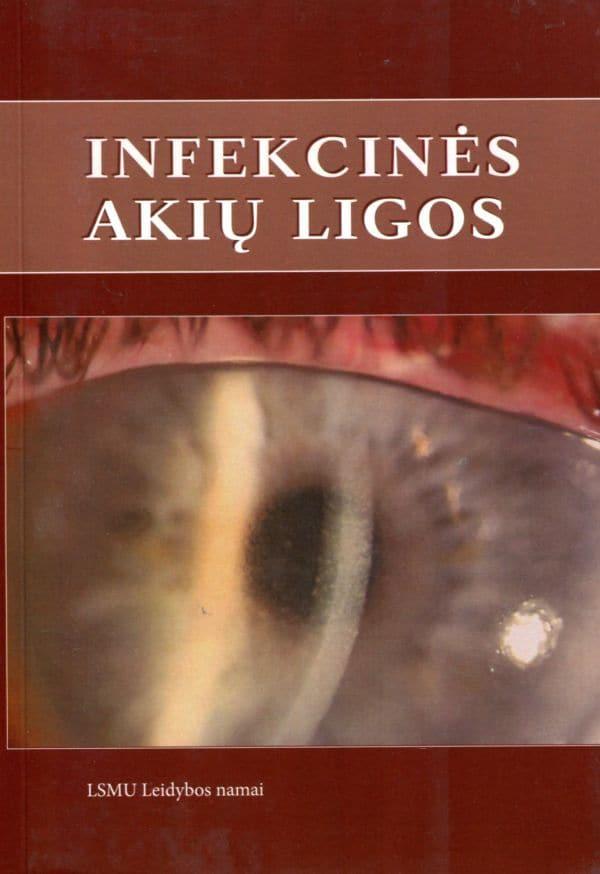 Infekcinės akių ligos