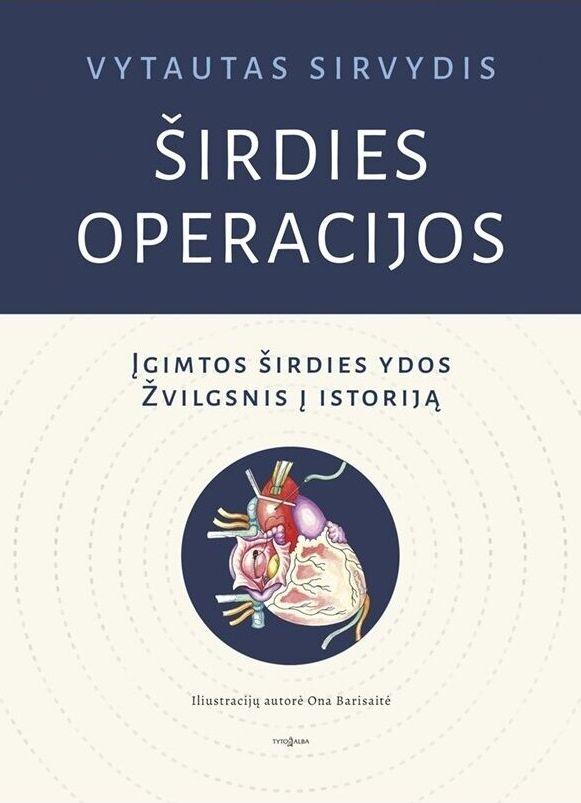 Širdies operacijos. Įgimtos širdies ydos