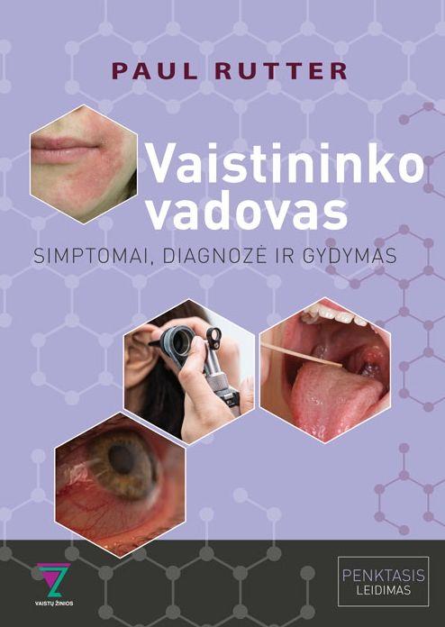 Vaistininko vadovas: simptomai, diagnozė ir gydymas