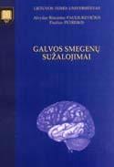 Galvos smegenų sužalojimai