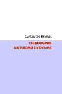 Chirurginis nutukimo gydymas