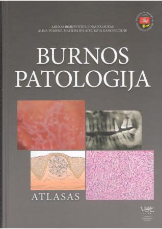 Burnos patologija. Atlasas
