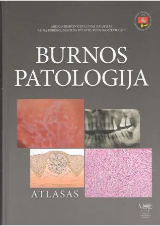 Burnos patologija. Atlasas