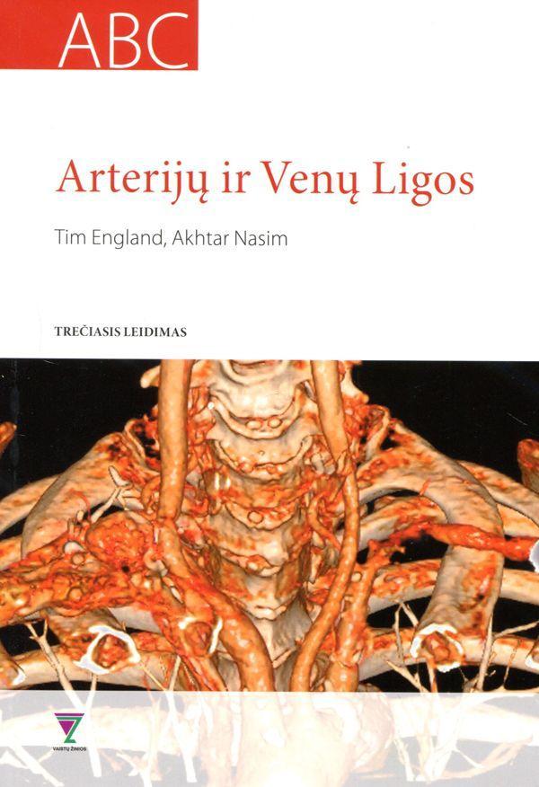 Arterijų ir venų ligos (3-ias leidimas)