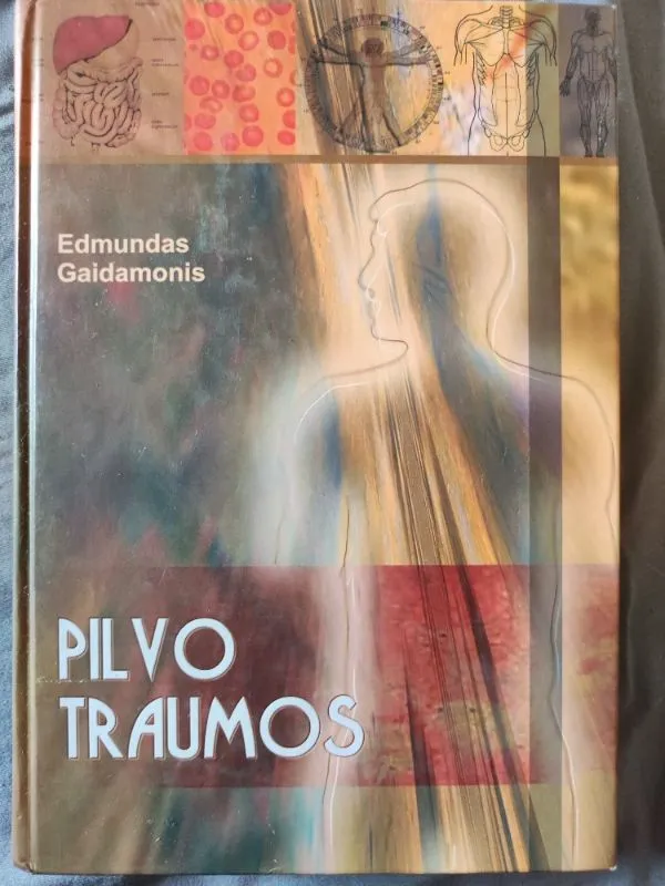 Pilvo traumos