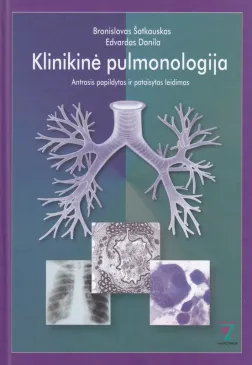 Klinikinė pulmonologija. Antrasis ir pataisytas leidimas