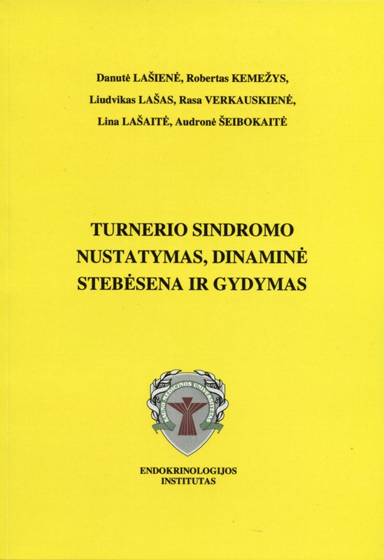 Turnerio sindromo nustatymas, dinaminė stebėsena ir gydymas